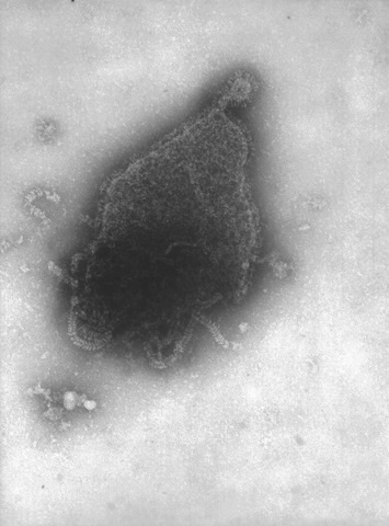 Human Parainfluenza Virus Type-4a (HPIV-4) - Paramyxoviridae family, genus Rubulavirus