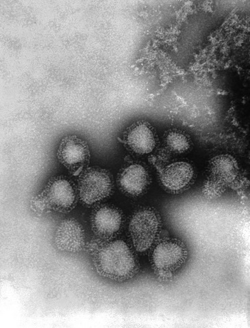 Hong Kong Flu Virus Virions (H3N2 Subtype)