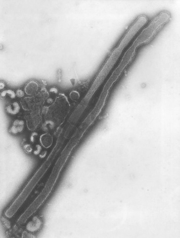 Micrograph of Orthomyxoviridae Virus Family Member