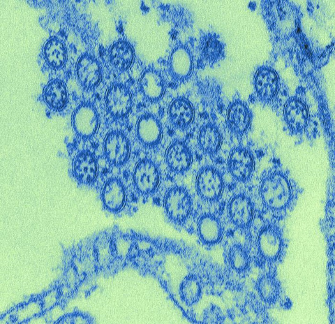 Virions From a Novel Flu H1N1 Isolate
