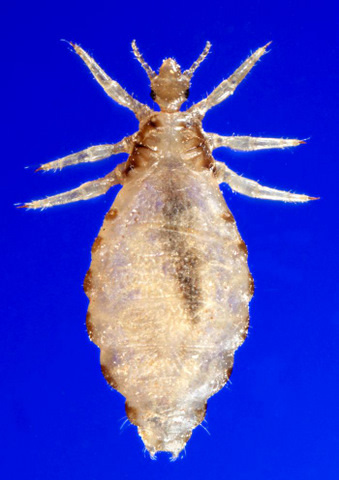 Dorsal View of a Female Body Louse (Pediculus humanus var. corporis) 