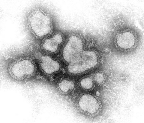 Influenza A Virions