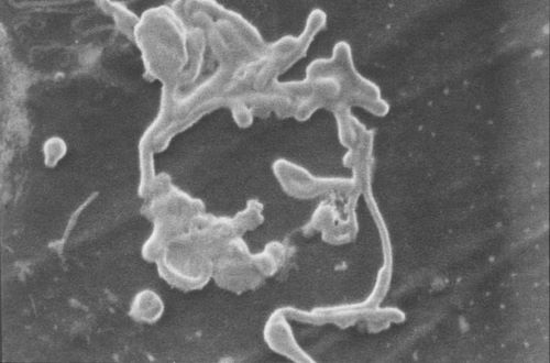 Scanning electron micrograph of Ebola Virion Discovered from the Ivory Coast of Africa.