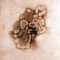 A/New Jersey/76 (Hsw1N1) Virus