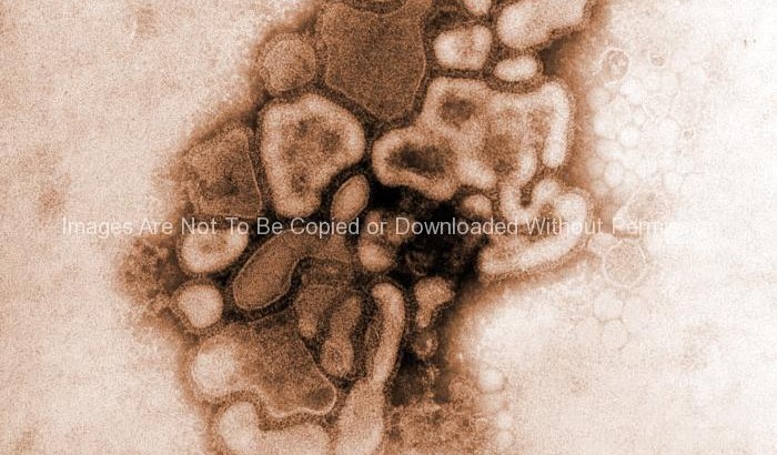 A/New Jersey/76 (Hsw1N1) Virus