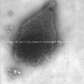 Human Parainfluenza Virus Type-4a (HPIV-4) – Paramyxoviridae family, genus Rubulavirus