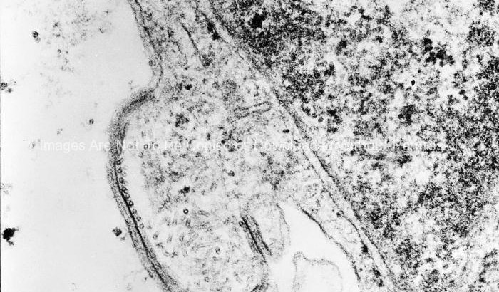 Human Parainfluenza Virus Type-4a (HPIV-4) – Paramyxoviridae family, genus Rubulavirus