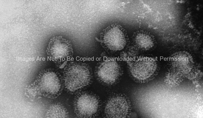 Hong Kong Flu Virus Virions (H3N2 Subtype)