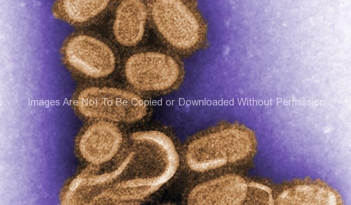 1918 Influenza Virions
