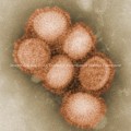 Morphology of the A/CA/4/09 Swine Flu Virus