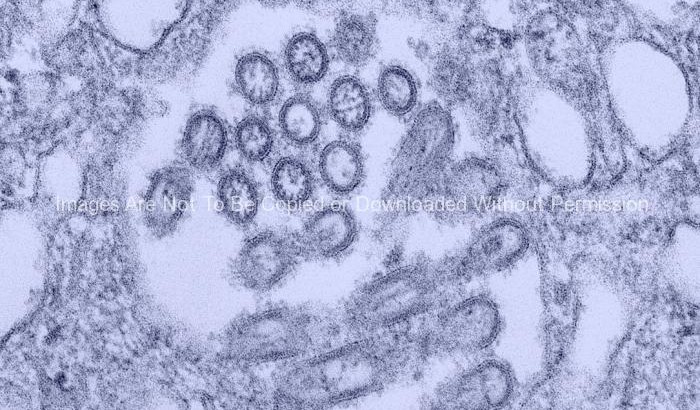 Novel H1N1 Virus Virions