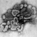A/New Jersey/76 (Hsw1N1) virus