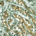 Electron Micrograph of Avian Influenza A