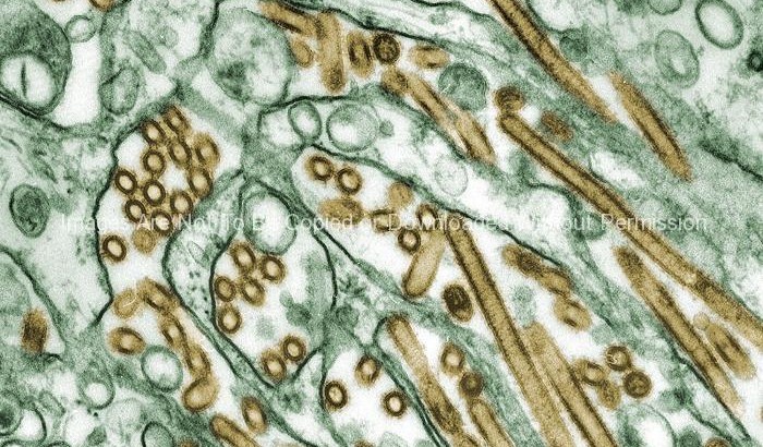 Electron Micrograph of Avian Influenza A