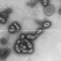 Russian Influenza-A H1N1, (A/USSR/90/77 strain)