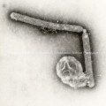 Ultrastructural Details of two Avian Influenza A (H5N1) Virions, a Type of Bird Flu Virus