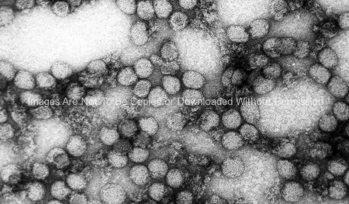 Virions of the Yellow Fever Virus