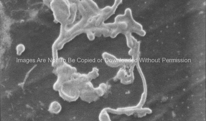 Scanning electron micrograph of Ebola Virion Discovered from the Ivory Coast of Africa