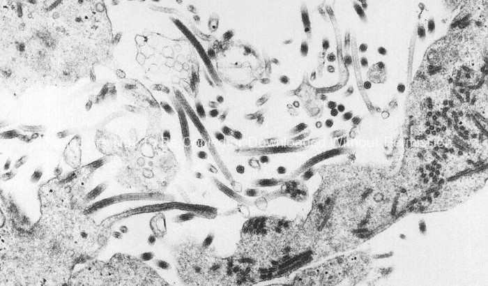 Thin section transmission electron micrograph (TEM) revealed some of the Ebola Virus