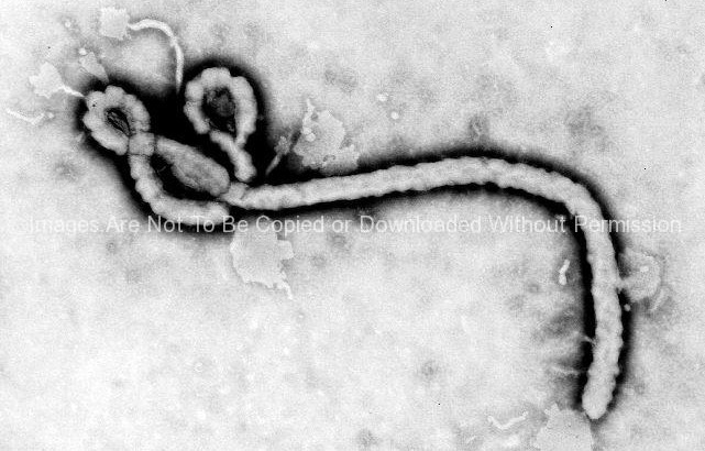 Ultrastructural Morphology Displayed by an Ebola Virus Virion
